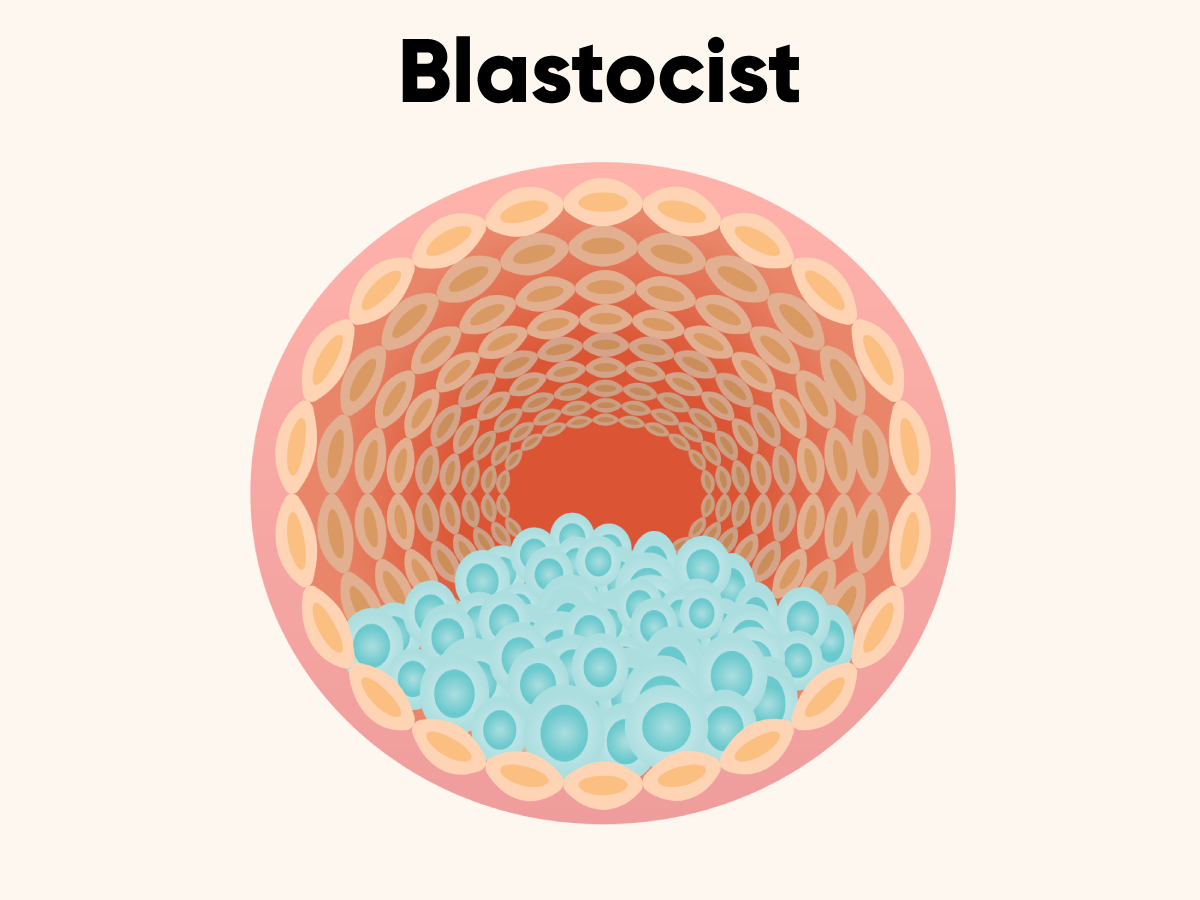 BLastocist