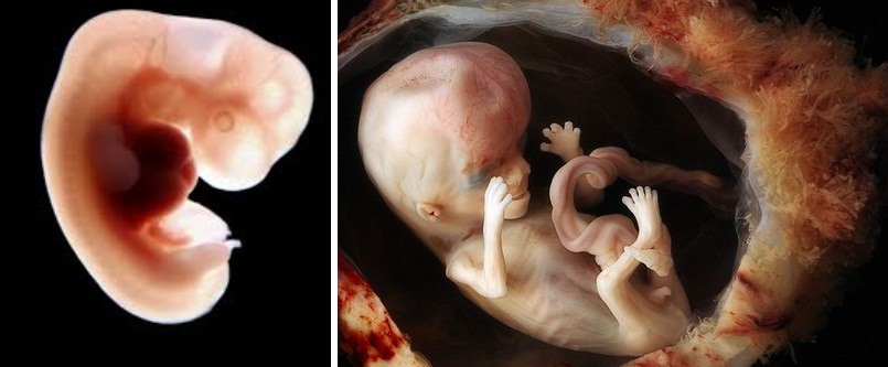 embrio fetus